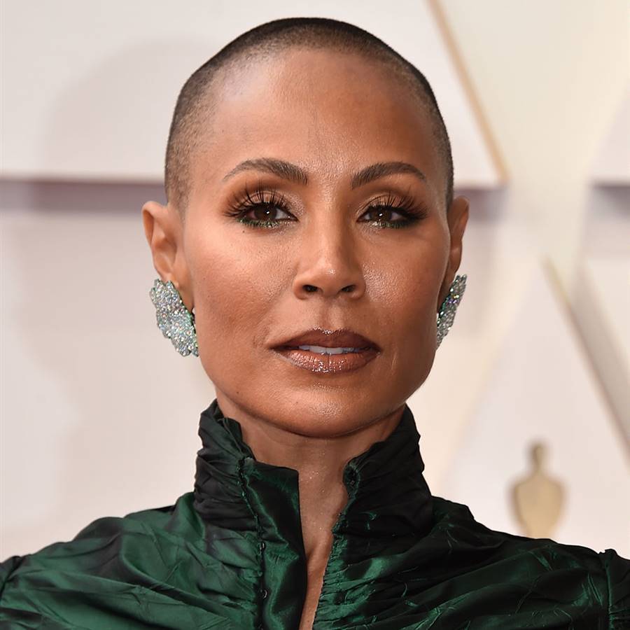 16 famosas que han sufrido alopecia femenina